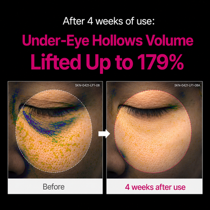 🔥LAST DAY 50% OFF!!Vlorna Korean Calcium Dark Spot Eye Cream