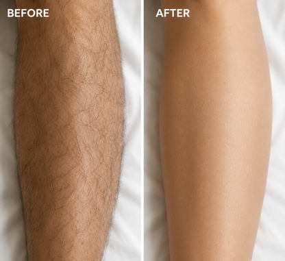 Vlorna™ Natural Gentle Hair Removal Cream | For Women & Men, Sensitive Skin