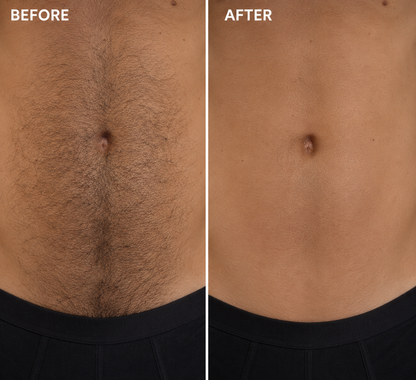 Vlorna™ Natural Gentle Hair Removal Cream | For Women & Men, Sensitive Skin