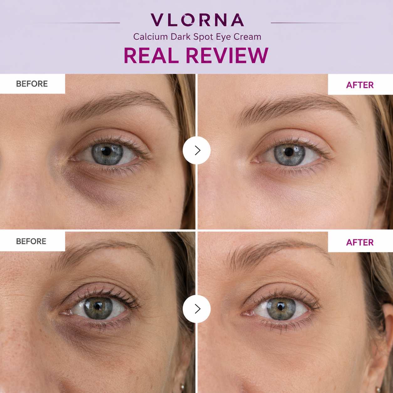🔥LAST DAY 50% OFF!!Vlorna Korean Calcium Dark Spot Eye Cream