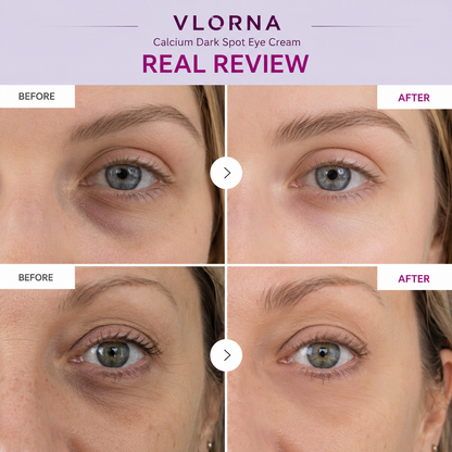 🔥LAST DAY 50% OFF!!Vlorna Korean Calcium Dark Spot Eye Cream