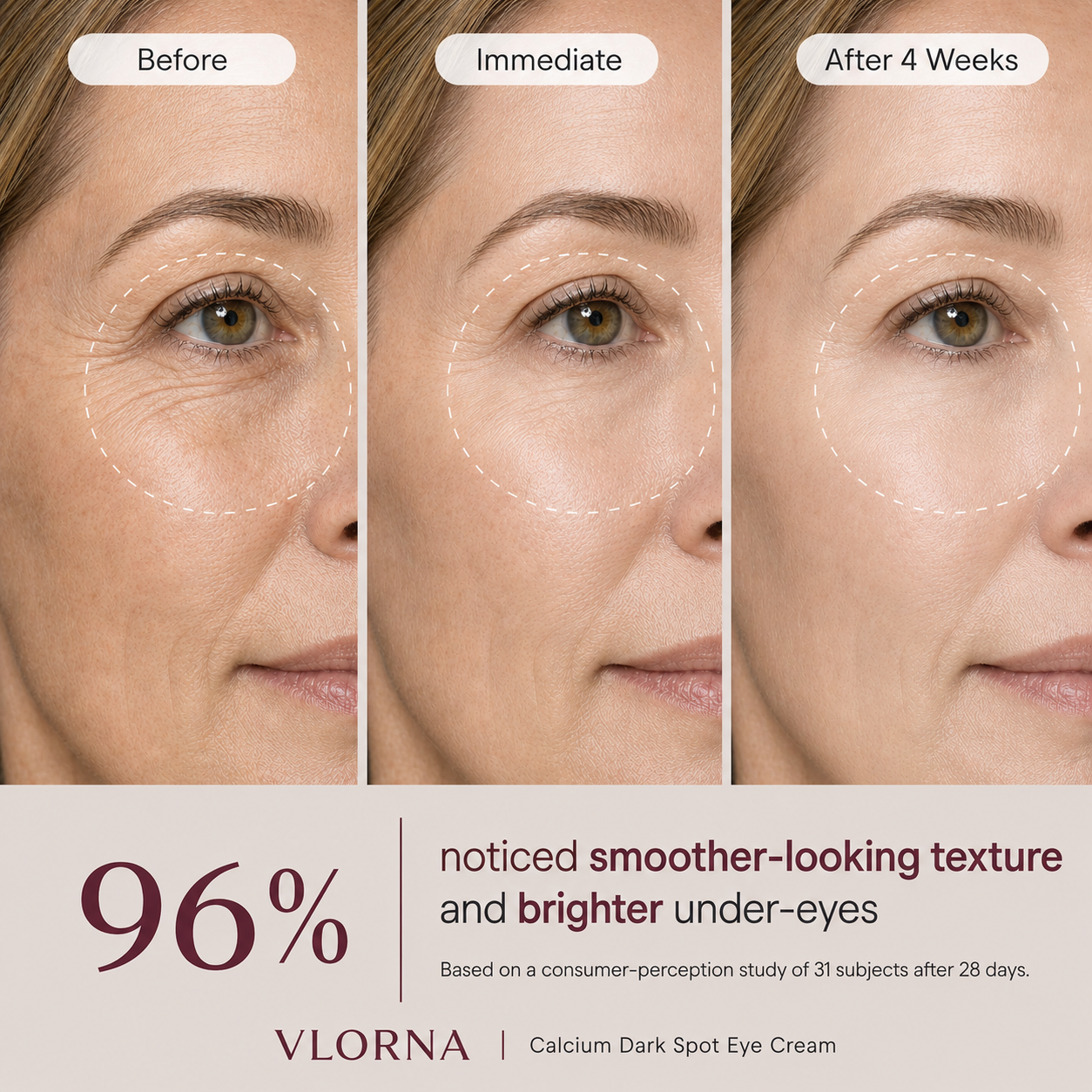 🔥LAST DAY 50% OFF!!Vlorna Korean Calcium Dark Spot Eye Cream