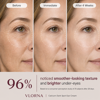 🔥LAST DAY 50% OFF!!Vlorna Korean Calcium Dark Spot Eye Cream